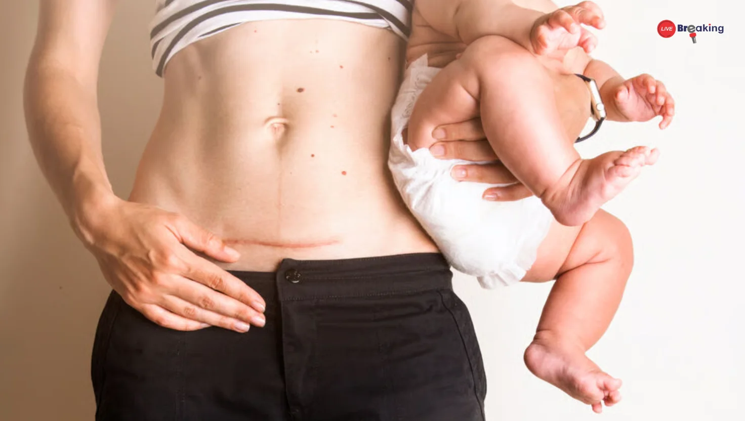 Recovering After Childbirth