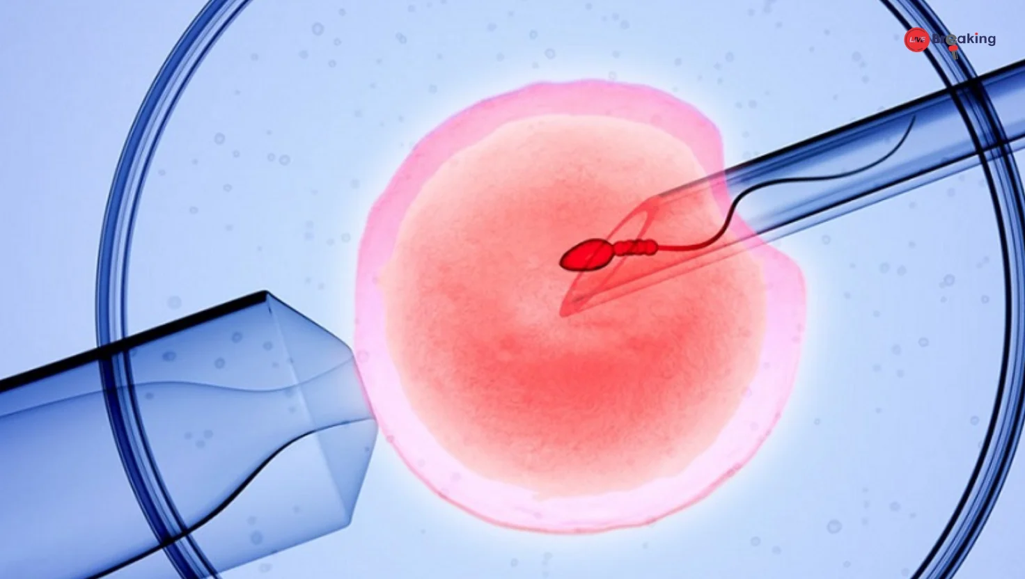 Understanding IVF Treatment